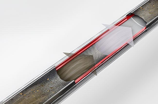 DYSON 492689-01 DP20 Pencilvac Fluffycones 