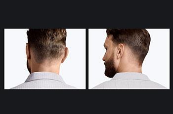 BRAUN HC5530 Series 5 κοντά μαλλιά